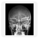 nailskull.jpg
